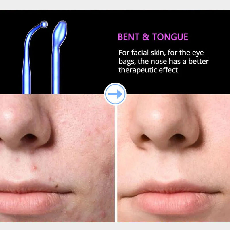 High Frequency Facial Machine - Anti Aging & Acne Therapy