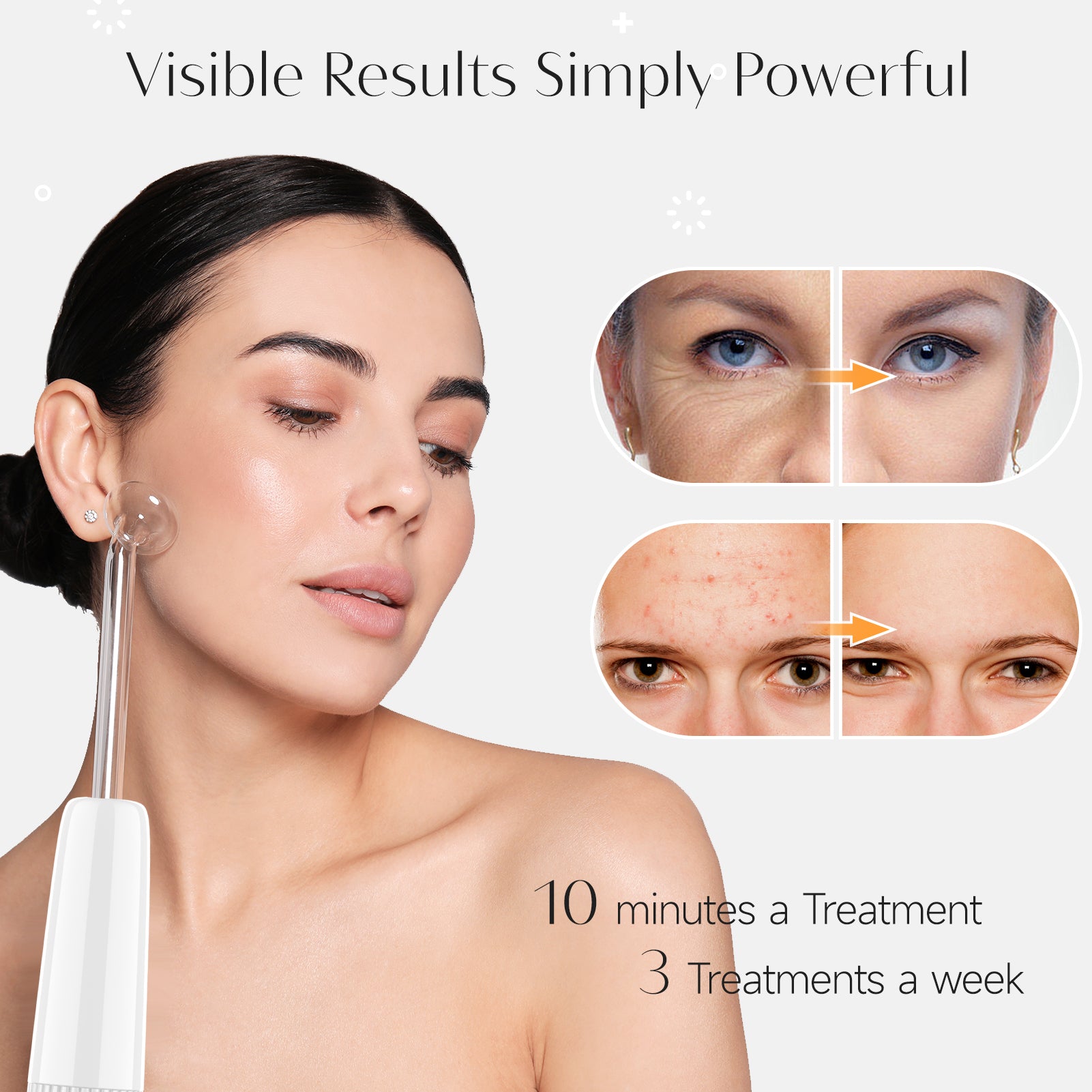 High Frequency Facial Machine - Anti Aging & Acne Therapy