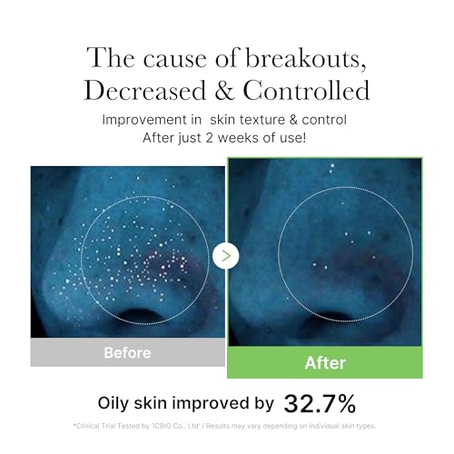 Exosome CICA Toner: Soothing Korean Skincare for Stressed Skin