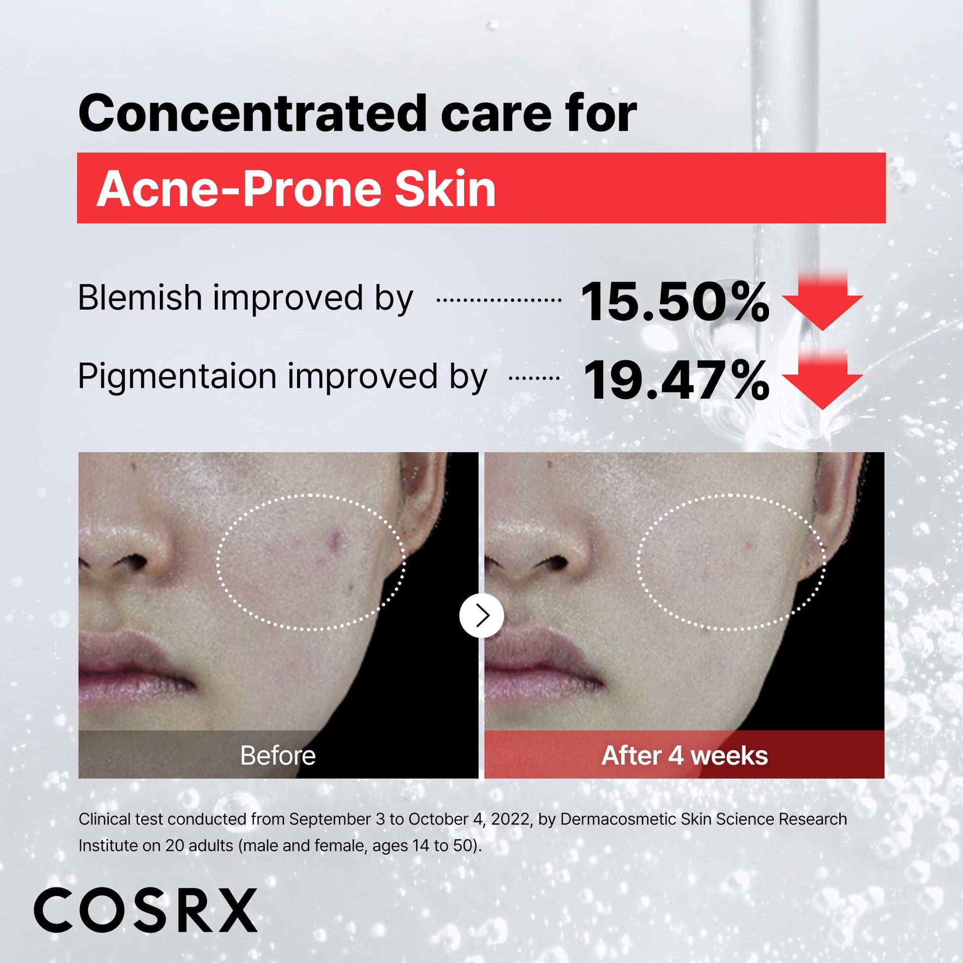 Niacinamide 15% Serum - Pore Minimizer, Even Tone, 0.67 fl oz