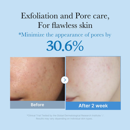 Zero Pore Toner: Exfoliate & Hydrate with AHA, BHA, PHA