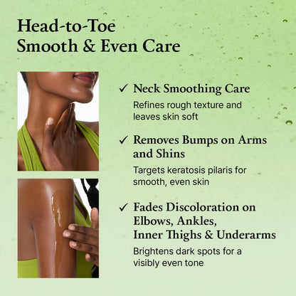 Green Tomato Acid Exfoliating Serum 21% AHA+BHA+PHA, 1.69oz