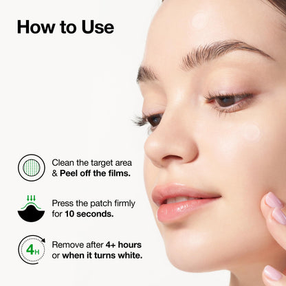 Anua Triple Acid Microdart Patch - 200+ Darts, Korean Skincare