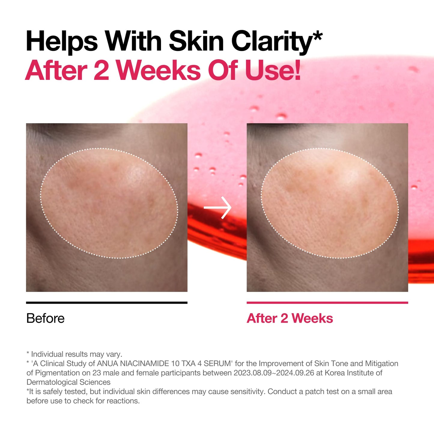 Niacinamide 10% Serum: Dark Spot & Glass Skin Solution