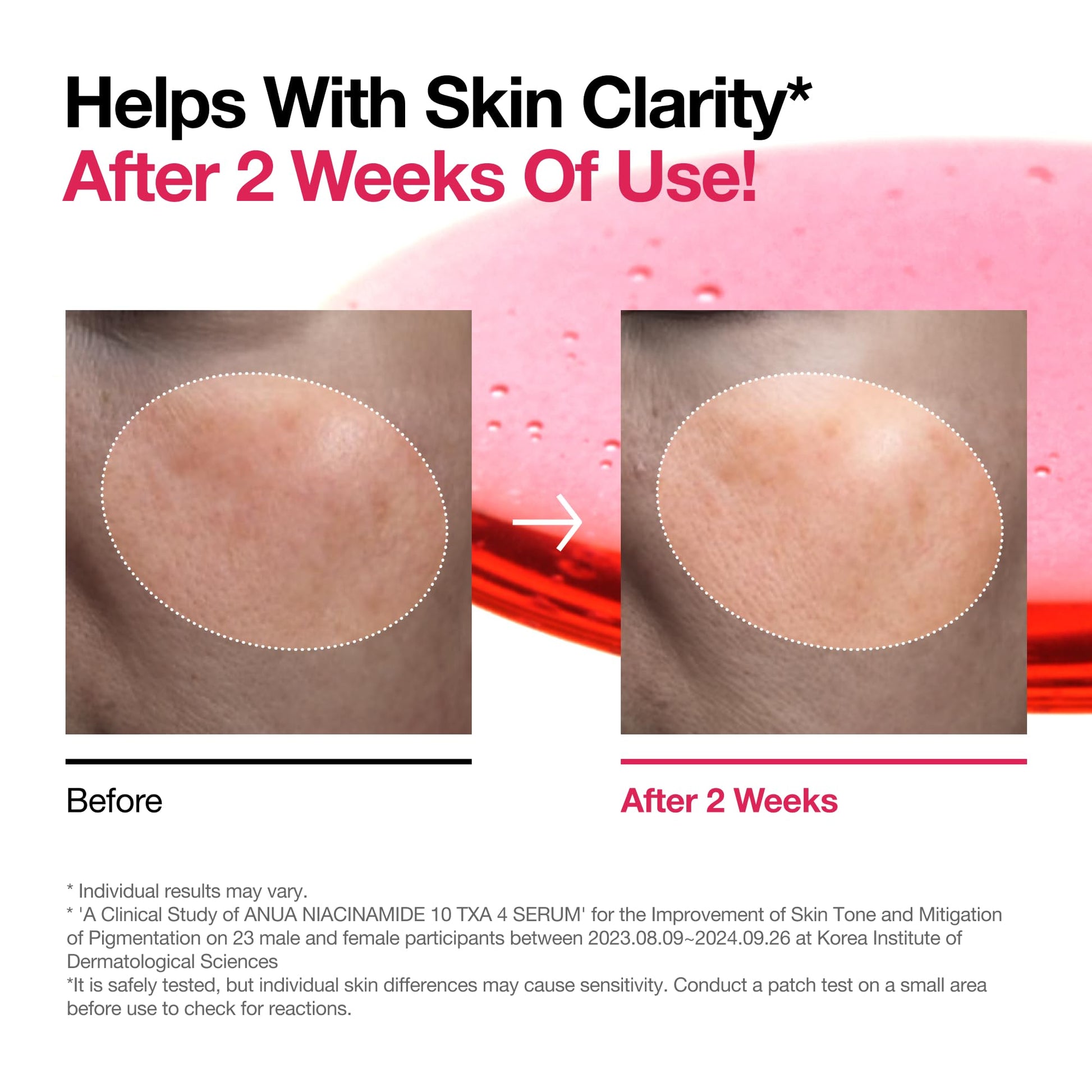 Niacinamide 10% Serum: Dark Spot & Glass Skin Solution