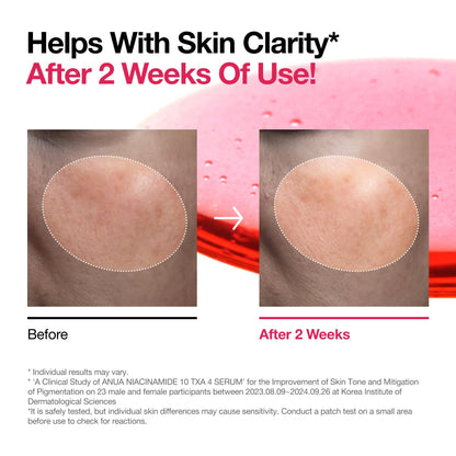 Niacinamide 10% Serum: Dark Spot & Glass Skin Solution