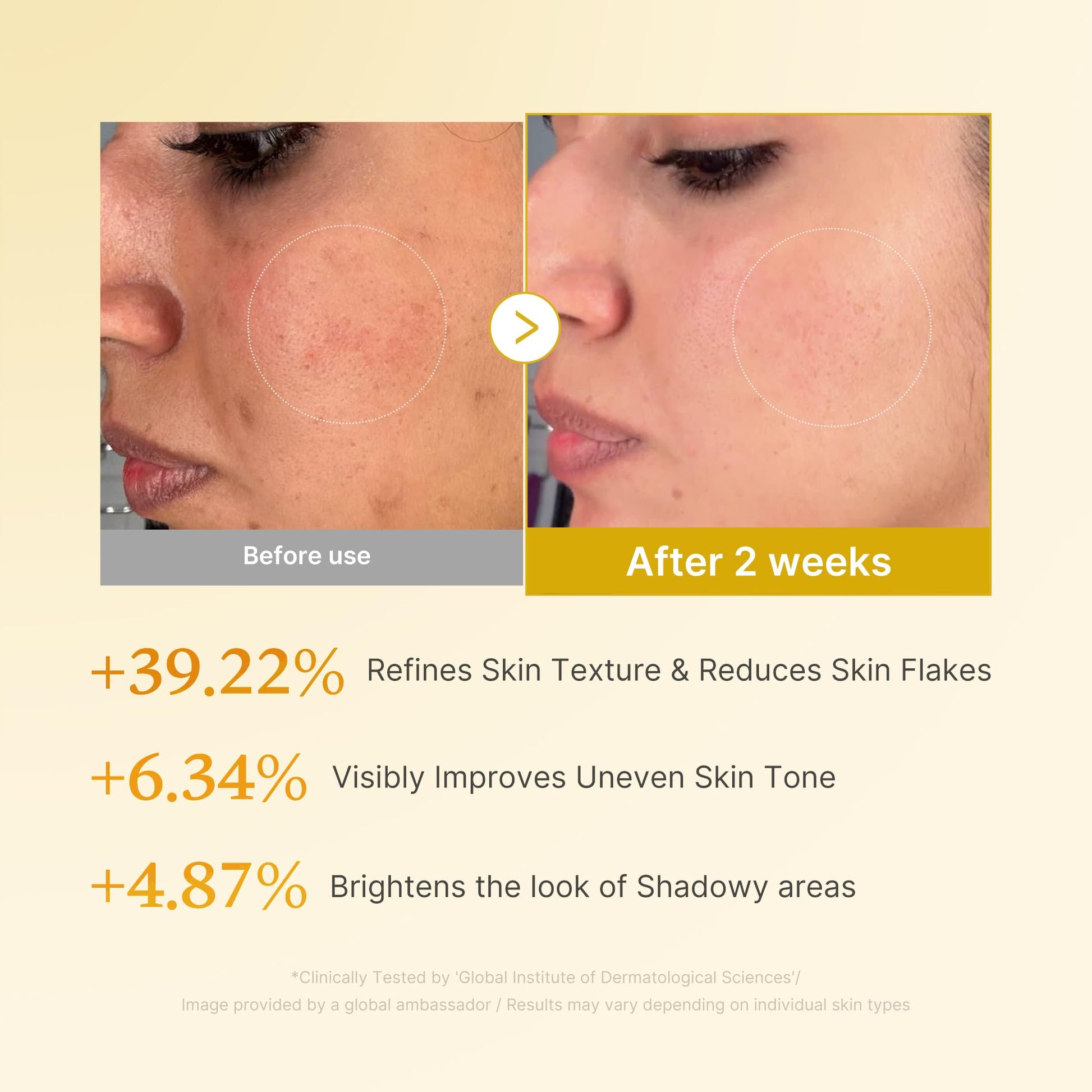Kojic Acid Turmeric Toner: Clear Glass Skin Solution