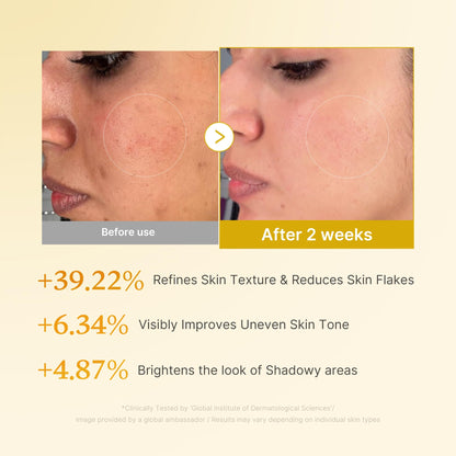 Kojic Acid Turmeric Toner: Clear Glass Skin Solution