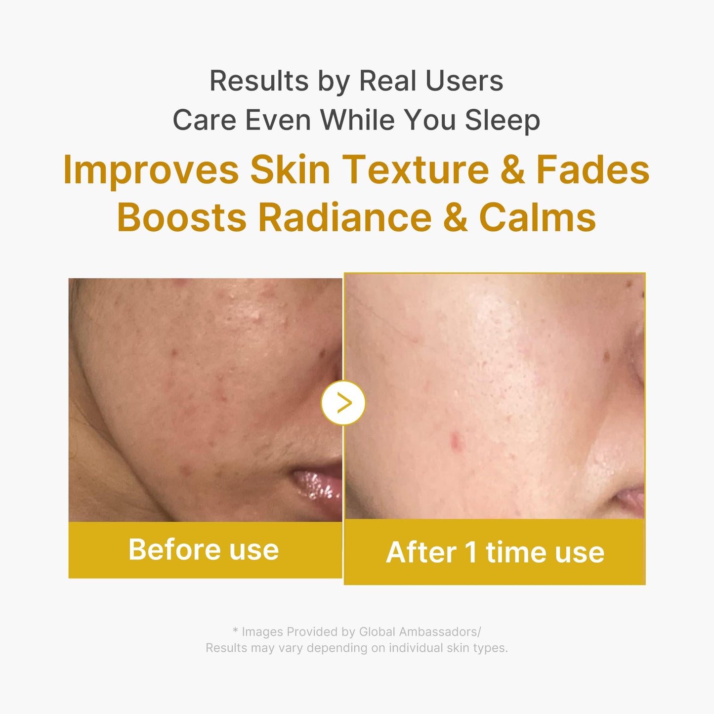 Medicube Korean Kojic Acid Overnight Mask - Glowing Skin Solution