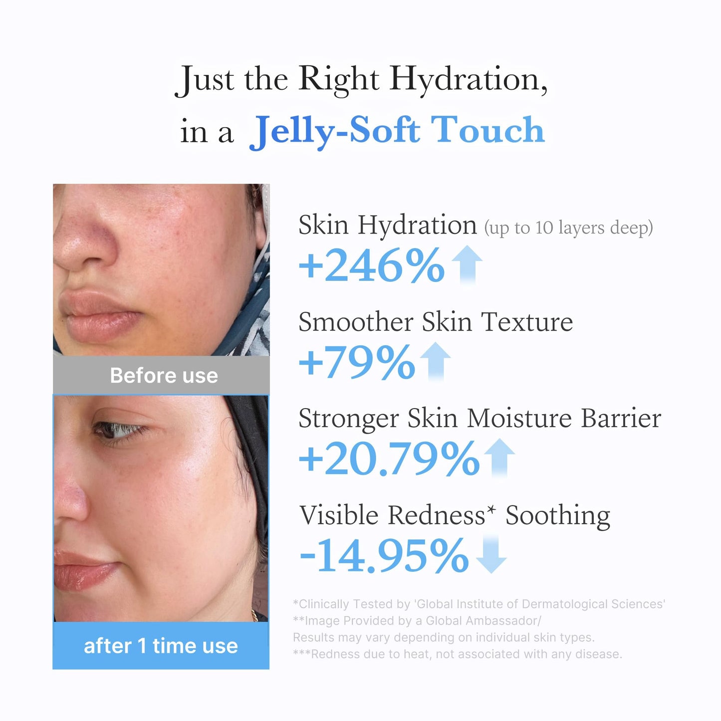Hyaluronic Acid Jelly Cream - Deep Moisture for All Skin Types