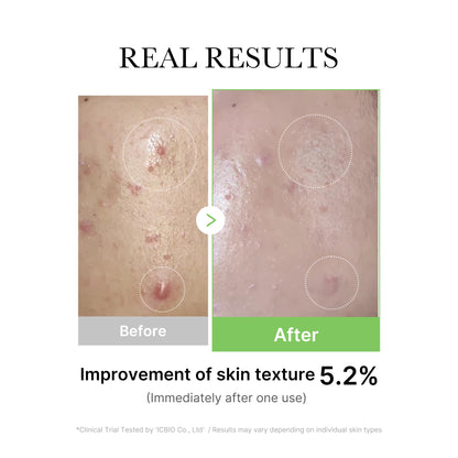 Exosome Cica Tea Tree Ampoule for Sensitive Skin - 30ml