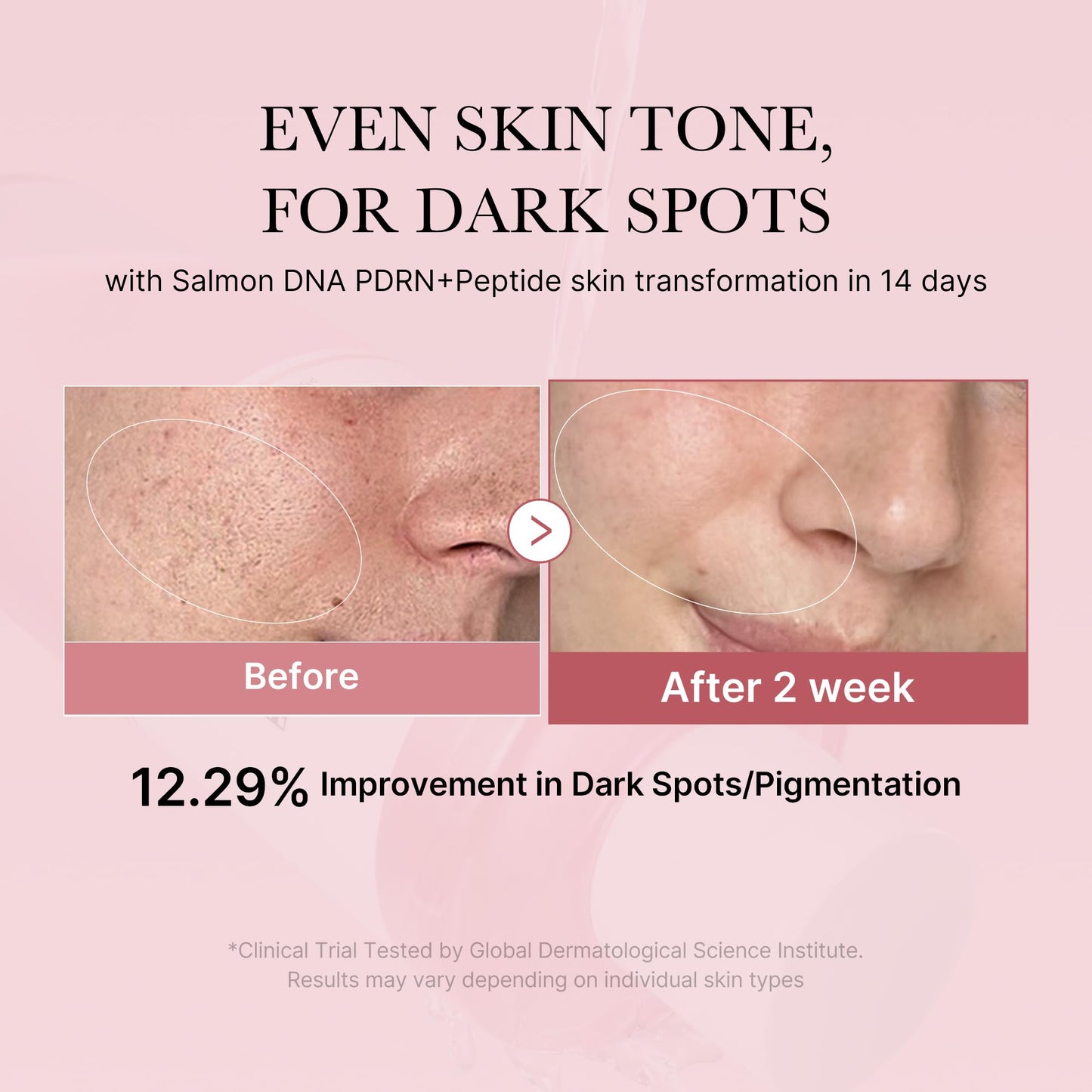 PDRN Toner Salmon DNA CICA Soothing - Korean Skincare 8.45oz
