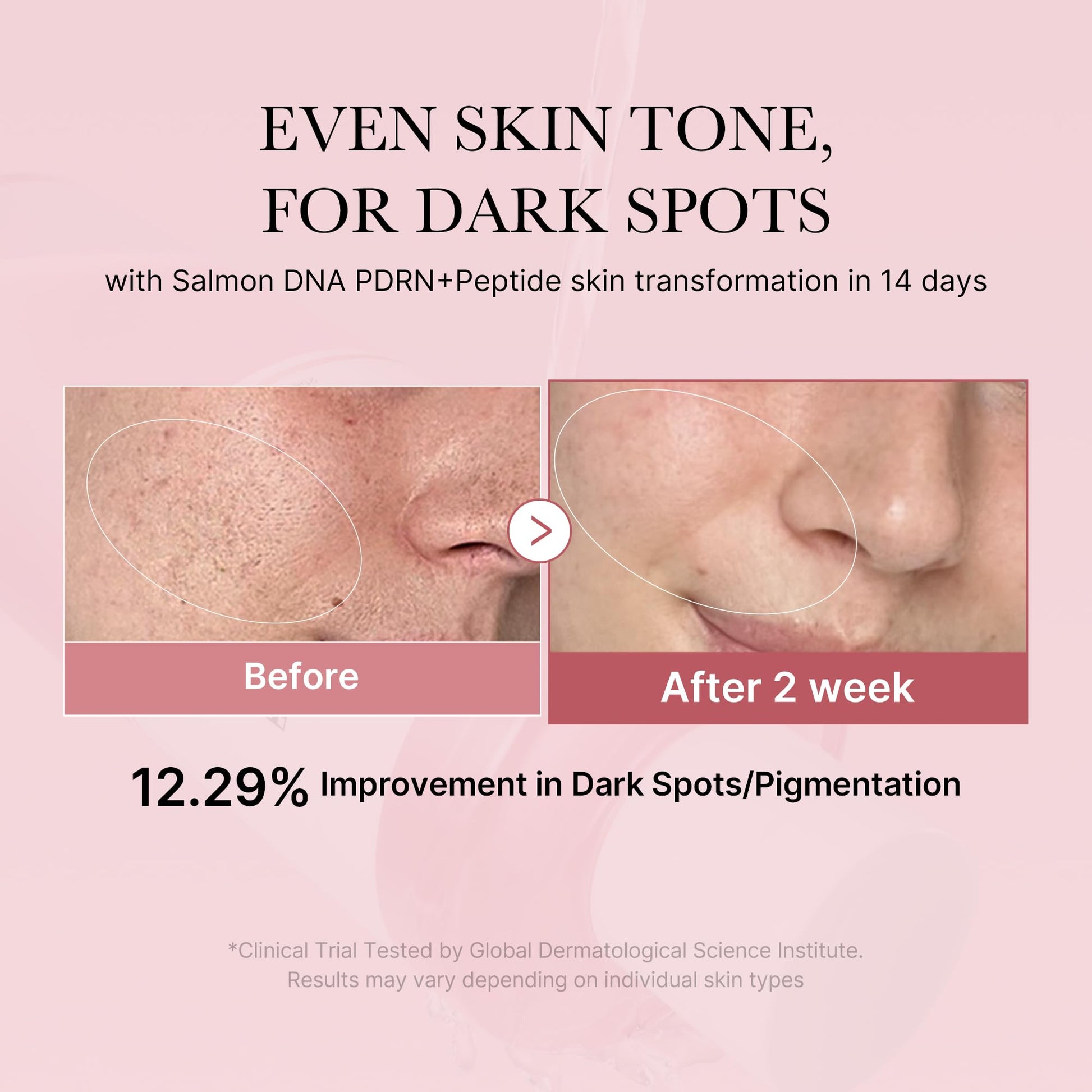 PDRN Toner Salmon DNA CICA Soothing - Korean Skincare 8.45oz