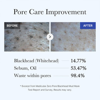 Medicube Zero Pore Mud Mask - Quick Dry, Pore Tightening