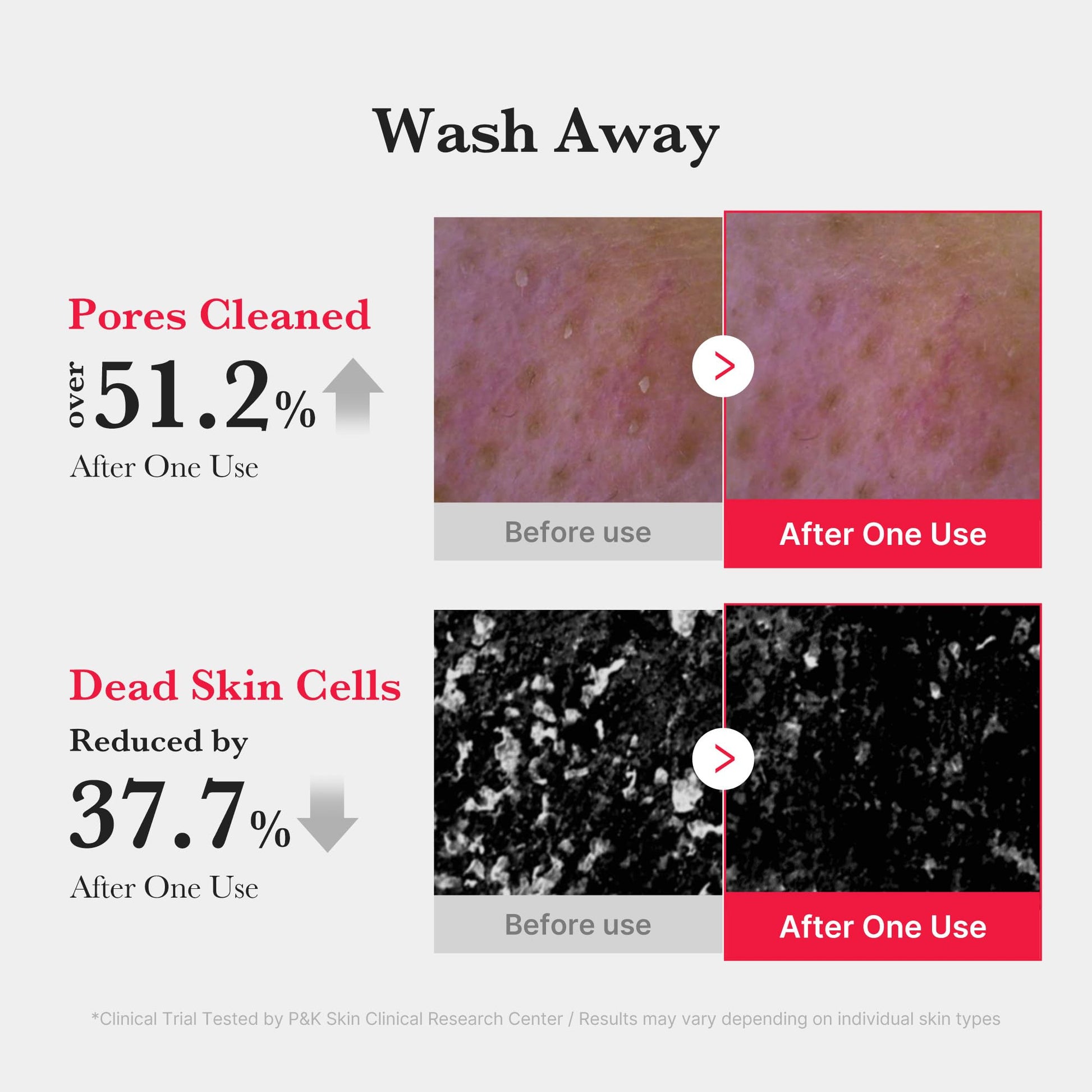 medicube Facial Cleanser Red Foam Cleanser | Daily Gentle Cleansing Foam for Sensitive & Troubled Skin | Deep Cleansing Impurities & Excess Sebum Control | Korean Skincare, 4.23 oz