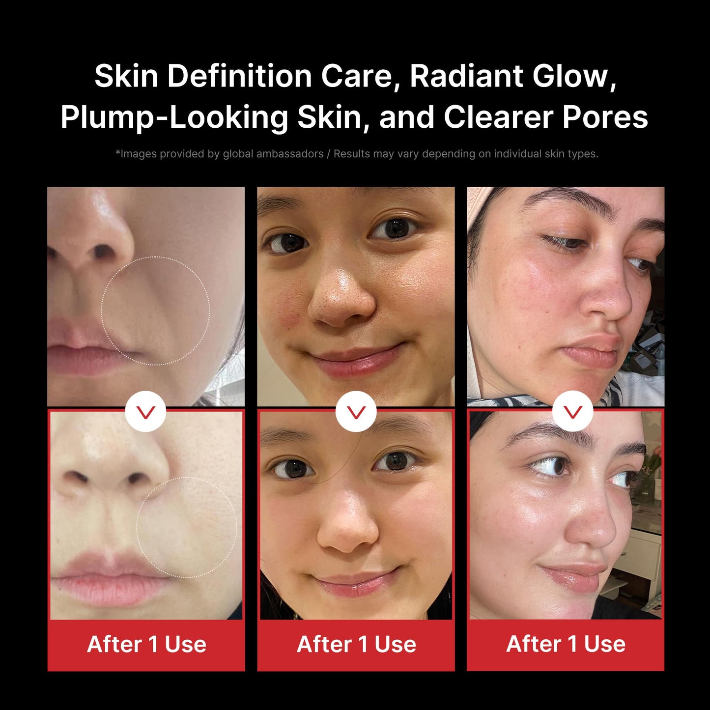 medicube Booster Pro 6-in-1 Glow Massager for Radiant Skin