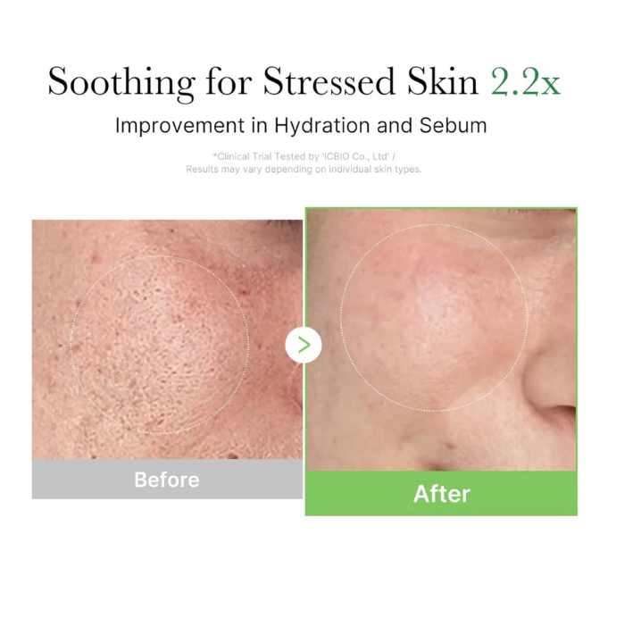 Medicube Exosome Cica Cream 50ml